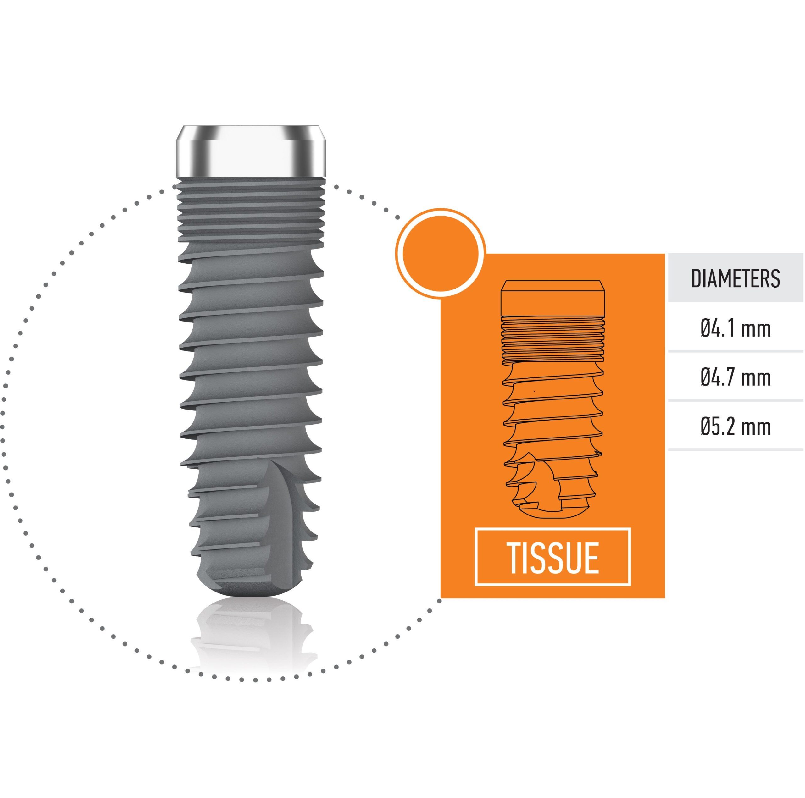 Mode Tissue Implant 